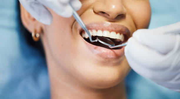 Best Urgent Care for Lost Fillings or Crowns in Hillsborough, CA