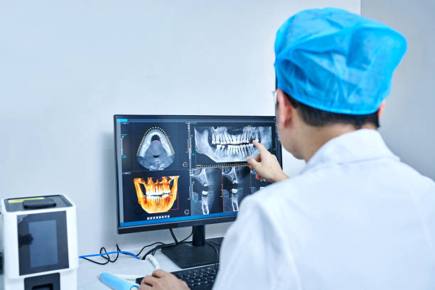 Best Emergency Root Canal Treatment in Hillsborough, CA
